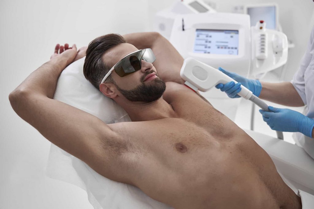 Laserowa depilacja ciała u mężczyzn